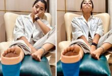 Rashmika Mandanna confirms about sustaining leg injury; pens note apologizing to filmmakers: Bollywood News