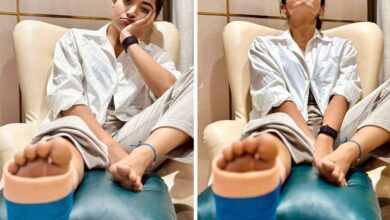 Rashmika Mandanna confirms about sustaining leg injury; pens note apologizing to filmmakers: Bollywood News