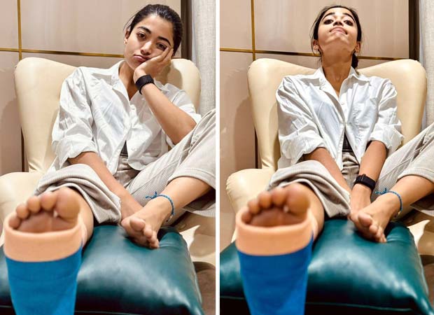 Rashmika Mandanna confirms about sustaining leg injury; pens note apologizing to filmmakers: Bollywood News