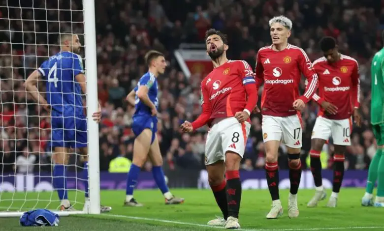 Manchester United vs Leicseseter City Live Streaming Fa Cup Live Telecast: When and where to watch