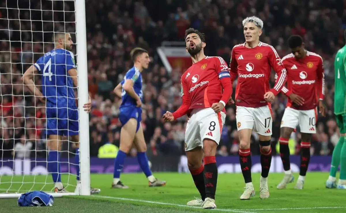 Manchester United vs Leicseseter City Live Streaming Fa Cup Live Telecast: When and where to watch